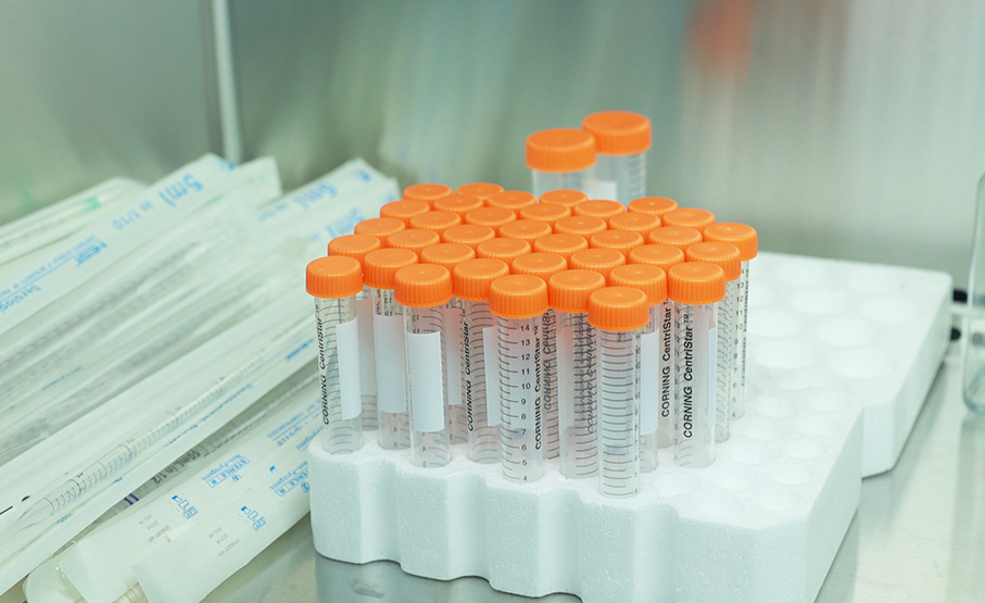 重组蛋白表达服务